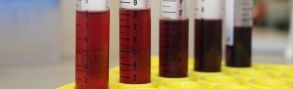 Bild Forschungsprojekt